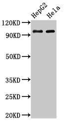 ACO1 antibody