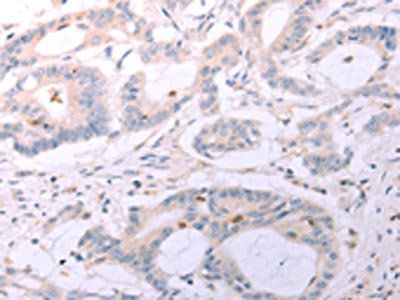 ACOT2 Antibody
