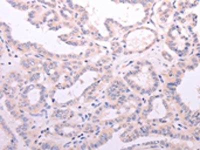 ACOT2 Antibody
