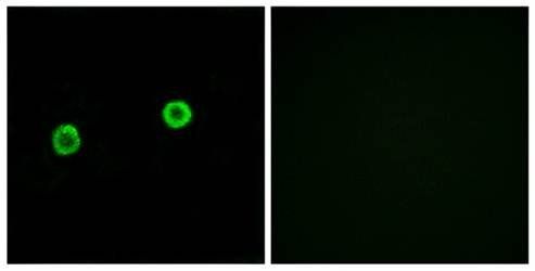 ACOT4 antibody