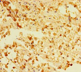 ACOT6 antibody