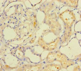 ACOT6 Antibody