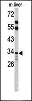 ACOT8 antibody