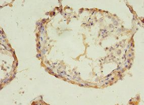 ACOT9 Antibody