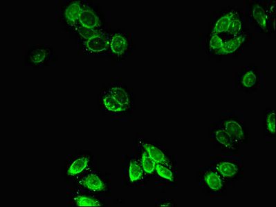 ACOX1 Antibody