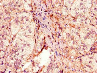 ACOX1 Antibody