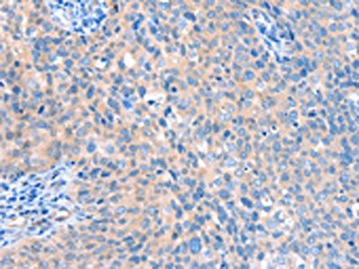 ACOX1 Antibody