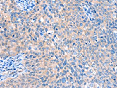 ACOX1 antibody