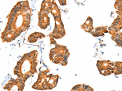 ACOX1 Antibody