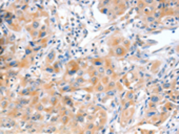 ACOX2 antibody