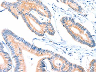 ACOX2 Antibody