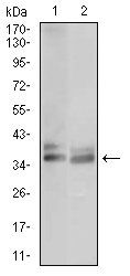 ACP5 Antibody