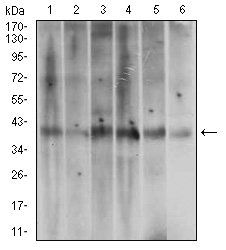 ACP5 Antibody