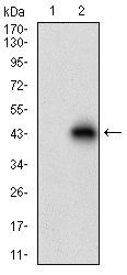 ACP5 Antibody