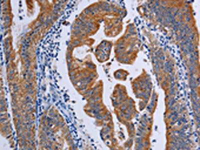 ACP6 Antibody