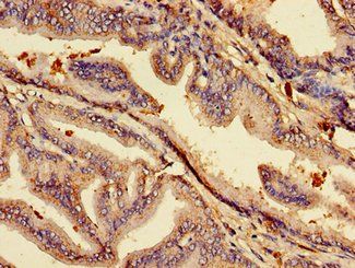 ACP6 Antibody