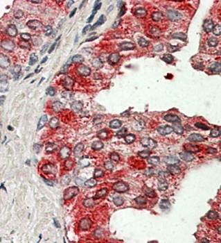 Goat anti-ACPP / PAP Antibody