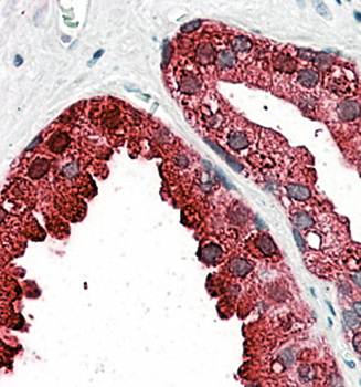 Goat anti-ACPP / PAP (aa269-282) Antibody