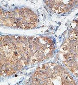 ACRBP Rabbit Polyclonal Antibody
