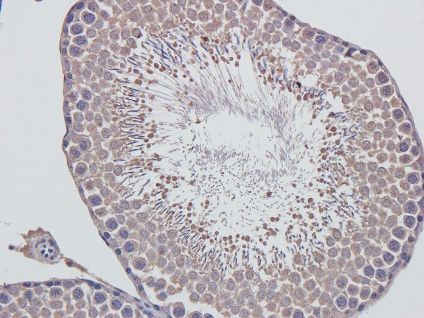 Acrosin antibody