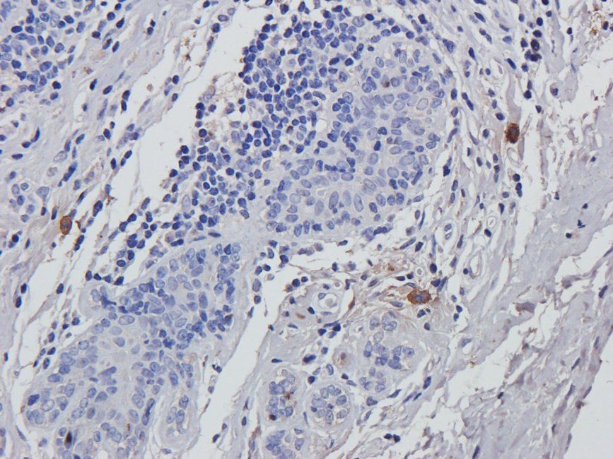 Acrosin antibody