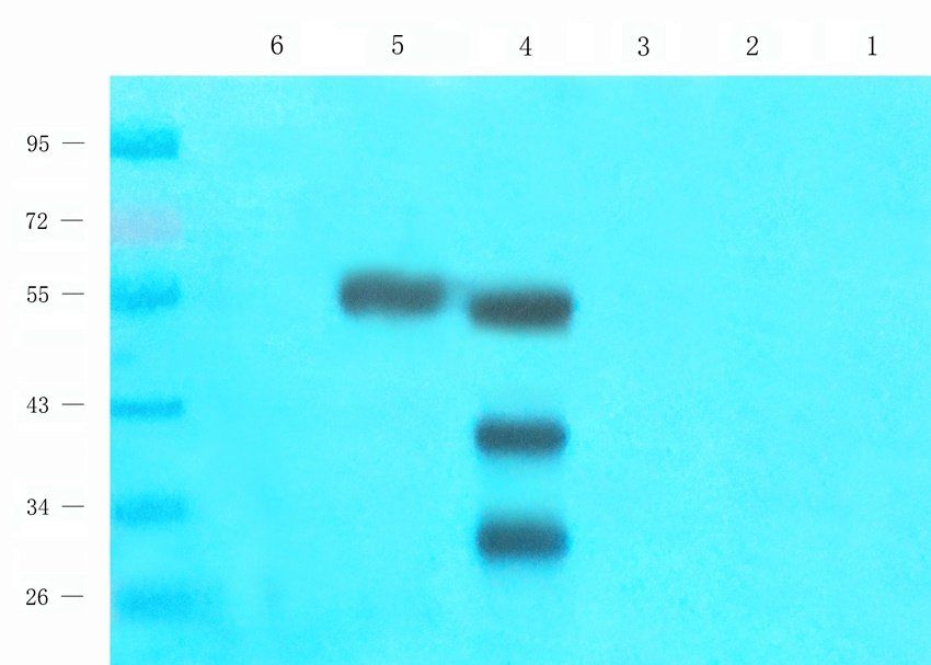 Acrosin antibody