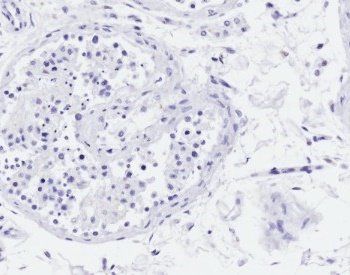 Goat anti-Acrosin light chain Antibody