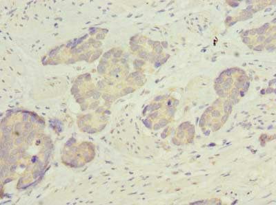 ACSBG2 Antibody