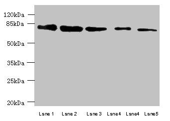 ACSBG2 Antibody
