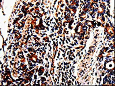 ACSBG2 Antibody