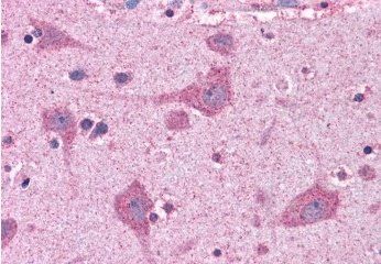 Goat anti-FACL4 / ACSL4 Antibody