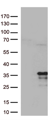 ACSL5 Antibody