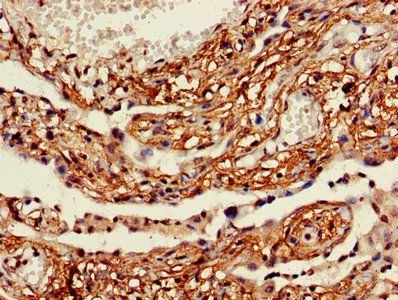 ACSL5 Antibody
