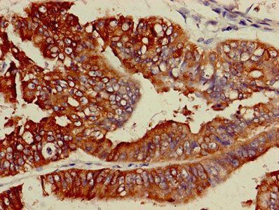 ACSL5 Antibody