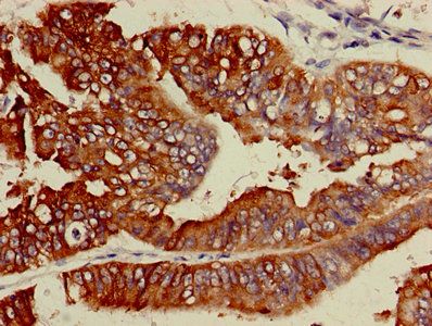 ACSL5 antibody