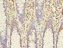 ACSL5 Antibody
