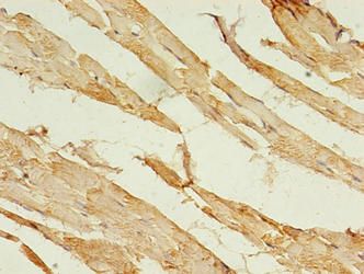 ACSL5 Antibody