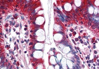 Goat anti-ACSL5 Antibody