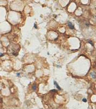 ACSM2A Rabbit Polyclonal Antibody