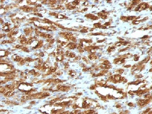 Actin, Muscle Specific (Muscle Cell Marker) Antibody