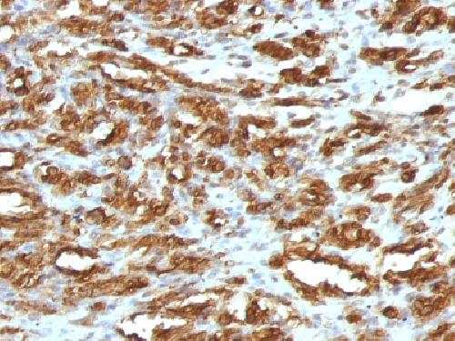 ACTA1 antibody