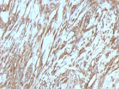 Actin, Muscle Specific (Muscle Cell Marker) Antibody