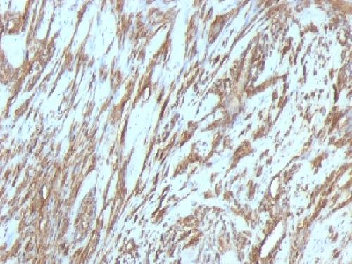 ACTA1 antibody