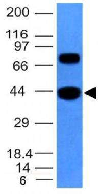 Actin, Muscle Specific (Muscle Cell Marker) Antibody
