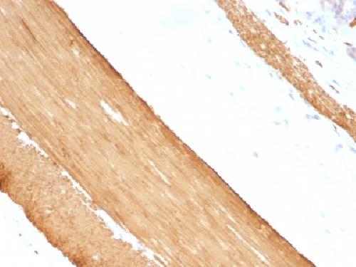 Actin, Muscle Specific (Muscle Cell Marker) Antibody