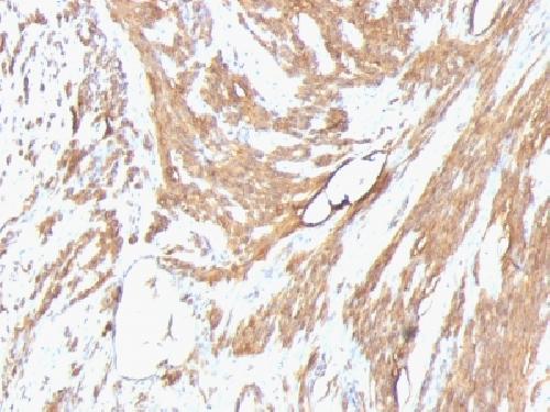 Actin, Muscle Specific (Muscle Cell Marker) Antibody