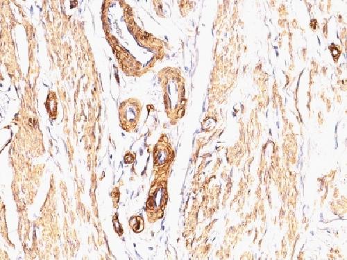 ACTA2 Antibody