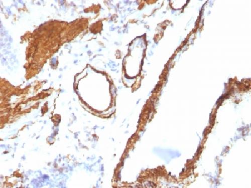 Actin, Smooth Muscle (Leiomyosarcoma Marker) Antibody