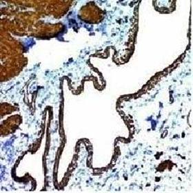 Actin, Smooth Muscle (Leiomyosarcoma Marker) Antibody