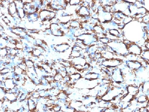 Actin, Smooth Muscle (Leiomyosarcoma Marker) Antibody